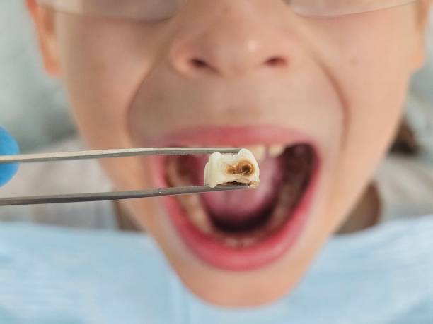 Best After-Hours Dental Trauma Care in Ithaca, MI